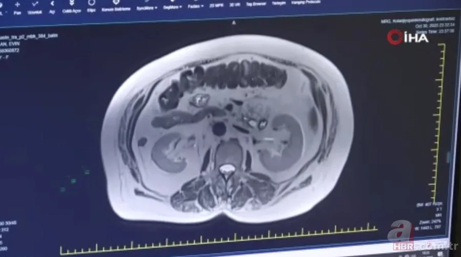 İnanılmaz! Doktorları bile hayrete düşürdü: 66 yıldır iç organları tersine çalışıyor 3