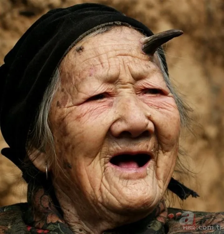 Bilim insanları şaşkın! Kafasında boynuz çıktı... 7