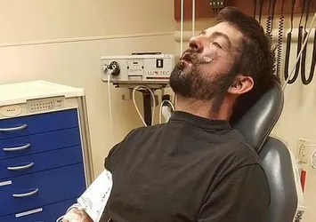 Suratında patladı! Keyfi uğruna 7 dişini kaybetti