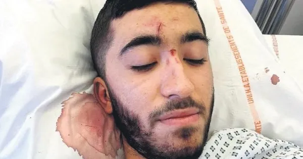 Fransa’da Türk aile ölümden döndü! Fransız polisi saldırganları korudu