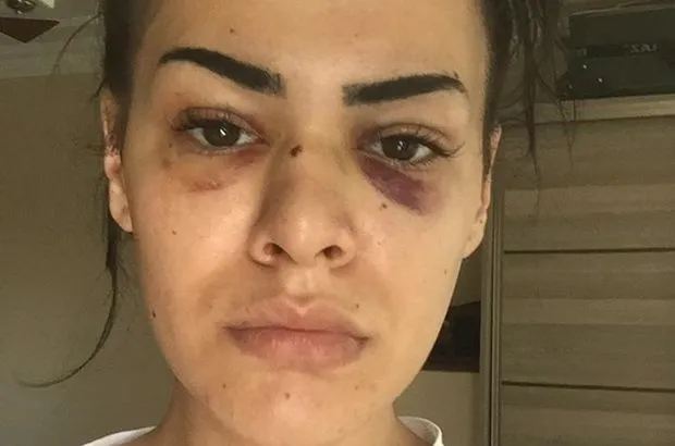 Tacize uğrayan ve şiddet gören Nagehan Bıyıklı: Korkudan evime gidemiyorum - 4
