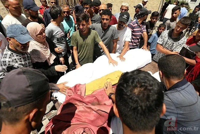 ABD'li doktor soykırımcı İsrail'in acımasızlığını herkese duyurdu: Karnından ve göğsünden vurulmuş çocuklar gördüm 6