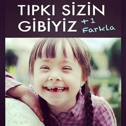 21 Mart Down Sendromu Günü sözleri, mesajları! Down sendromu nedir?