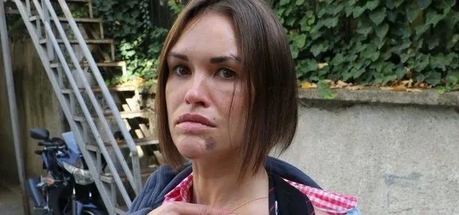 Ankara’da vahşet! Güzellik uzmanı Rus eşini öldüresiye dövdü