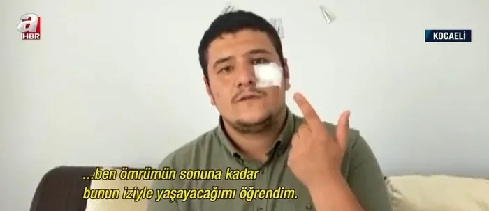 Saldırıya uğrayan İHA muhabiri Mustafa Uslu Meral Akşener’i yalanladı! "Kimse aramadı" - 4