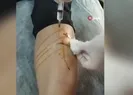 Köpeklerin saldırısına uğrayan kadın kabusu yaşadı