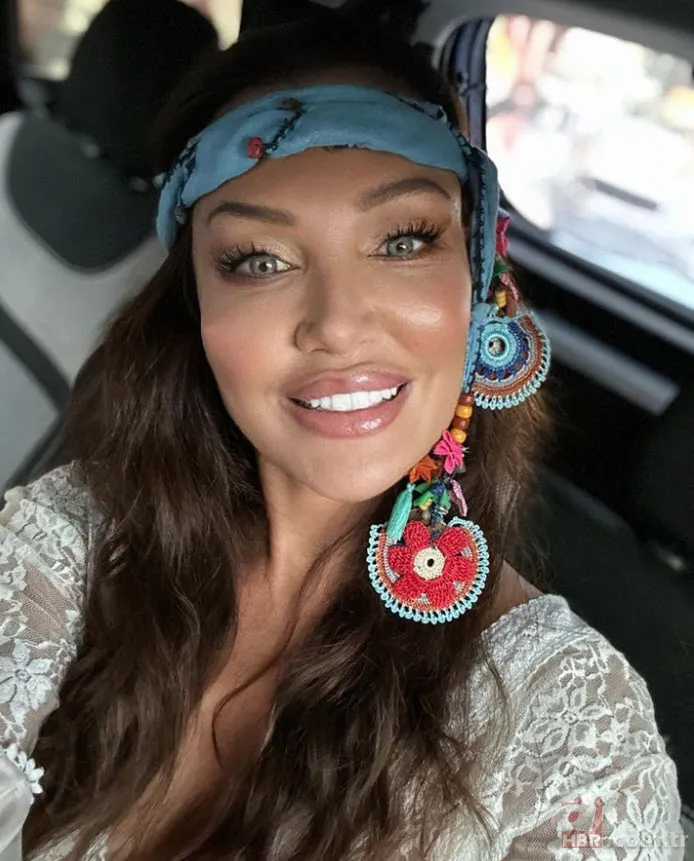 Böylesi görülmedi! Umut Akyürek bakın neresine estetik yaptırdı 5