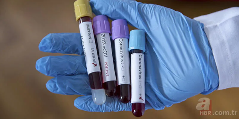 Çin'den Kovid-19 aşısıyla ilgili flaş açıklama! Son aşama kaldı 7