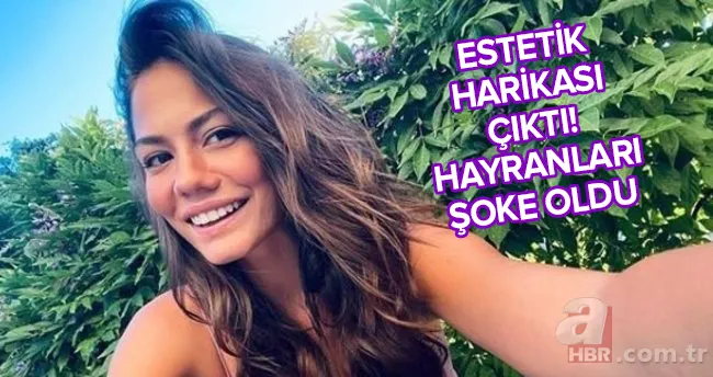 Kaderindir dizisinde Doğduğunuz Evden Zeynep Demet Özdemir bir estetik harikası! Görenler gözlerine inanamaz