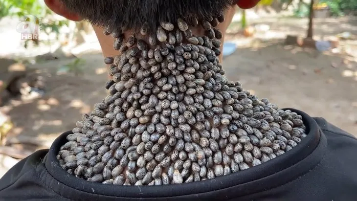 Ensesini görenlerin tüyleri diken diken oldu 🐞 Keneleri teker teker çıkardı | O anları sosyal medyadan paylaştı