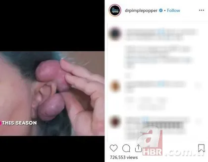 Güzellik uğruna kulağından oluyordu! Kan donduran görüntüler!