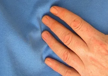 Uzmanı tek tek açıkladı! Kalp krizinden korunmanın yolları