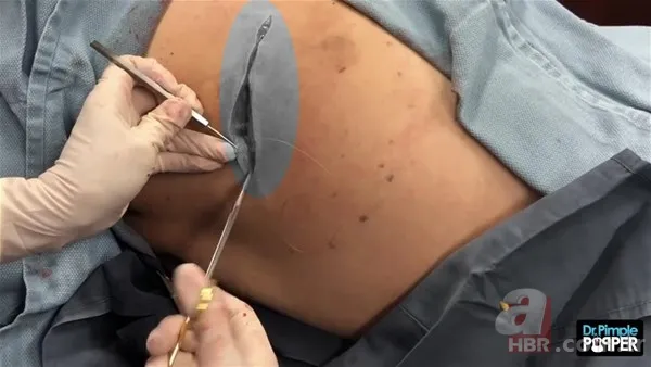 30 yıl boyunca baş ağrısıyla yaşadı! Nedeni şoke etti... 134