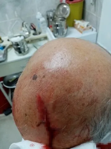 İzmir maganda dehşeti! Maske uyarısı yapan doktorun kafasını taşla yardı - 3