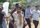İşte kameraman Ayhan Arıtürk’ün darp raporu