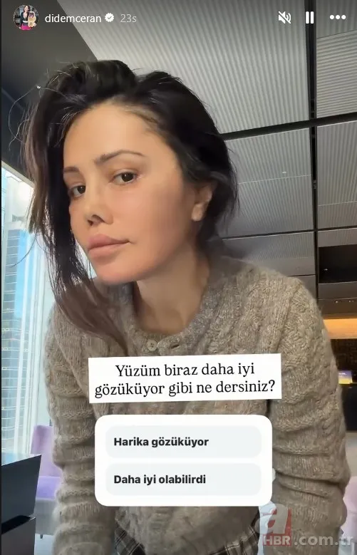 Yüz nakli sonrası ilginç gelişme! Didem Ceran'ın kaşında saç çıktı 7