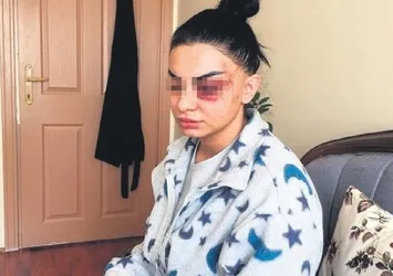 41 günlük evlilikte 4 kez dayak yedi: Emine Bulut gibi olmasın