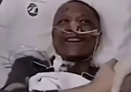 Son dakika: Koronavirüs sonrası ten rengi değişen Çinli doktorun son hali hayrete düşürdü