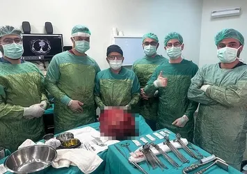 Karın ağrısı şikayetiyle gitti! İçinden çıkana inanamadı