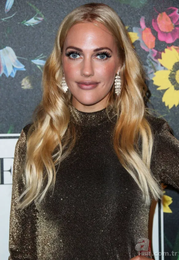 Ceyda Ateş’ten estetik itirafı! Set kazası kabusu oldu 3 kez ameliyat masasına yattı 25