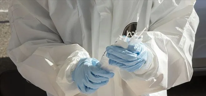 Son dakika: Bilim insanları açıkladı! Koronavirüs Kovid-19 plastikte 3 gün yaşıyor