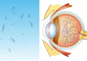 Görüşünüzdeki küçük lekeler neden olur? Bu sadece göz yanılması değil!