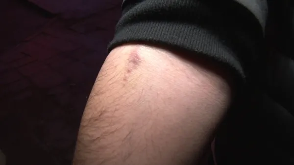 skandal-iddia-ortaligi-ayaga-kaldirdi-ozel-tip-merkezindeki-bir-doktordan-hastaya-tuzak-morfin-bagimlisi-halin-1670407711251.jpg Skandal iddia ortalığı ayağa kaldırdı! Özel tıp merkezindeki bir doktordan hastaya tuzak! Morfin bağımlısı haline getirip yüz binlerce lirasını aldı - 4