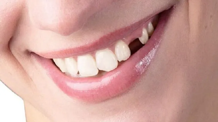 Kaybettiğiniz Dişlerin Yenisinin Çıkması Mümkün Olabilir! Japon bilim insanı fareler üzerinde ilk aşamayı tamamladı