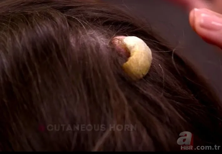 Bilim insanları şaşkın! Kafasında boynuz çıktı... 6