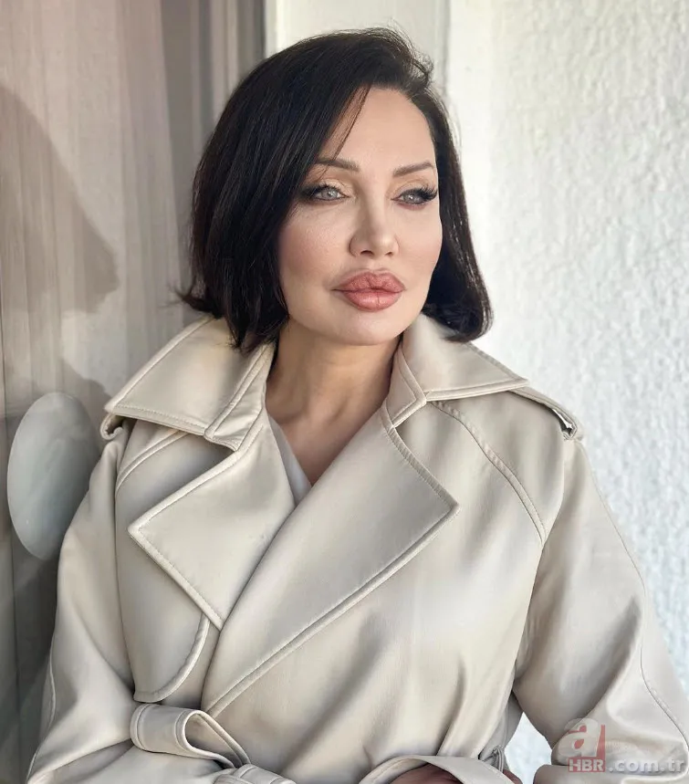 Böylesi görülmedi! Umut Akyürek bakın neresine estetik yaptırdı 1