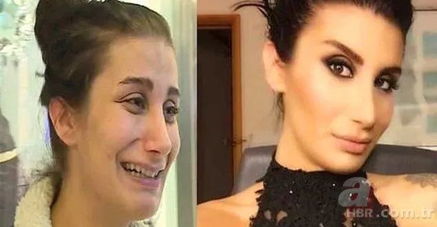 Fotoğrafı şaşkına çevirmişti! Demet Özdemir iddiaları ti’ye aldı! “Bugün estetiği fazla kaçırdım” 7