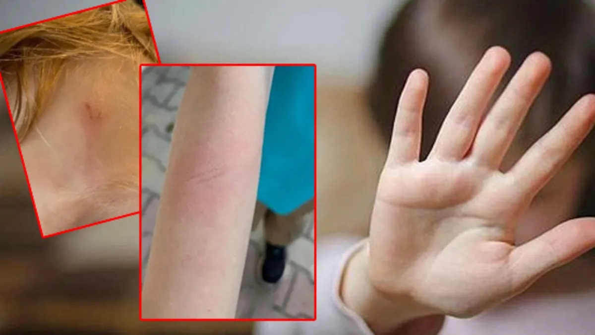 İstanbul'da öğretmen dehşeti! 7 yaşındaki çocuğu demir çubukla dövdü