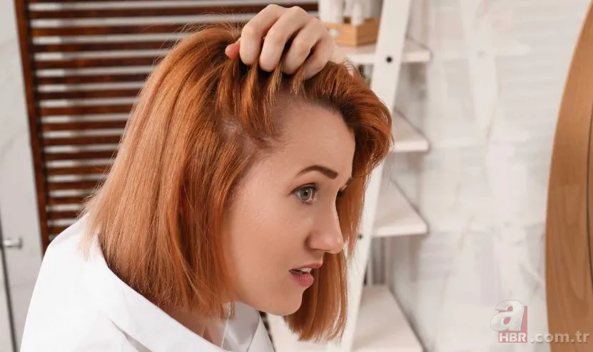 Kaşınan ve kepeklenen saçınız varsa dikkat! Bu yöntemle hem rahatlayacak hem de saçınızı uzatacaksınız 2
