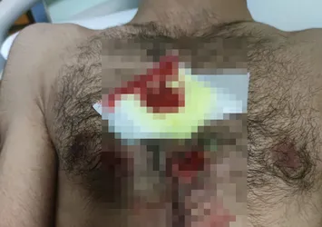Yunanistan'dan insanlık dışı muamele! Göçmenlere karşı plastik mermi