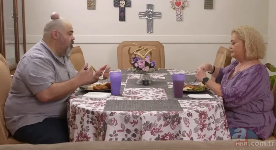 Sokağa şapka ile çıkıyordu! Başındaki şişlikten bakın ne çıktı 👩⚕️ Görenleri şaşkına çeviren olay 22