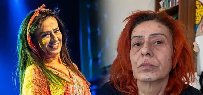 Yıldız Tilbe saçlarını kısacık kestirdi! Yaralarım geçmeyecekti