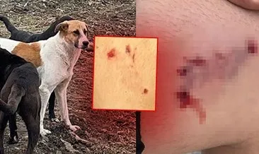 16 yaşındaki çocuğa sokak köpeği saldırdı!