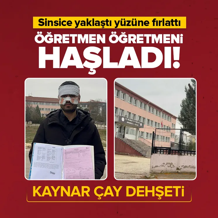 Lisede dehşet anları! Öğretmenin yüzüne kaynar çay fırlattı