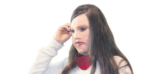 Yüz nakli tarihe karışabilir