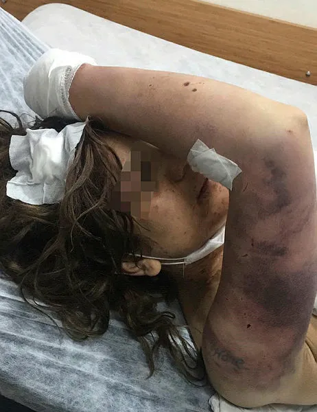 Şanlıurfa’da birlikte yaşadığı kadına işkence eden sanığa 34 yıla kadar hapis istemi - 1