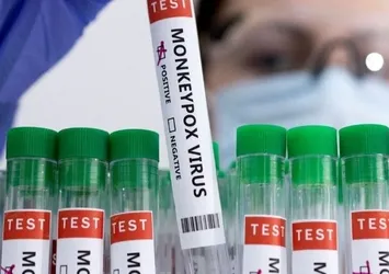 ABD'nin 7 eyaletinde "maymun çiçeği" virüsü alarmı