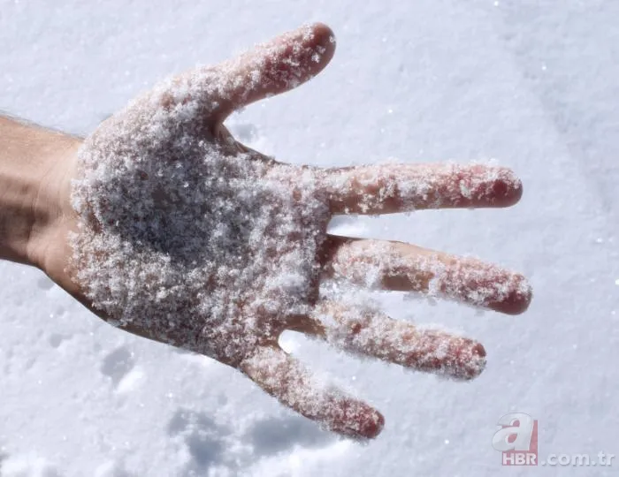 Chilblains ne demek? Chilblains hastalığı belirtileri neler? Galatarasaylı Seri'nin hastalığı Chilblains nedir? 5