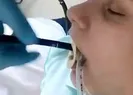Ağaç altında uyuyakalan kadına yılan şoku! Böyle çıkarıldı