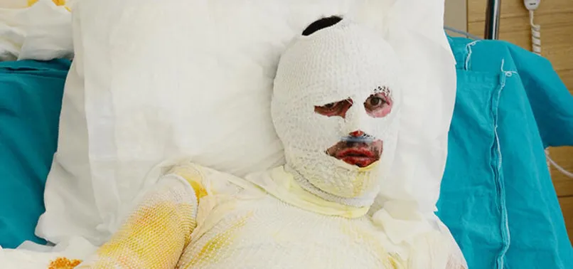 Erzurum'da feci olay! Eve giderken yıldırım düştü bu hale geldi