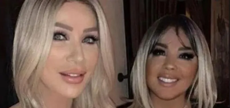 O iddialara Seda Sayan'dan flaş yanıt: Sazanlar hemen atlıyor