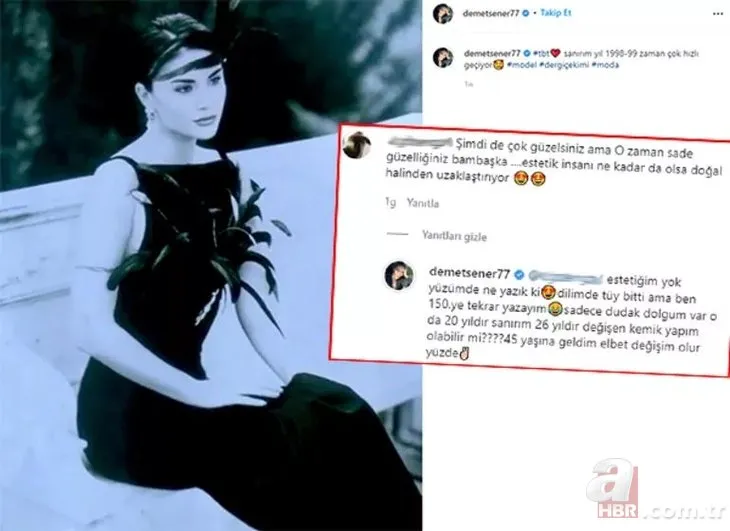 Demet Şener’den estetik iddialarına sert tepki: Kemik yapım değişti