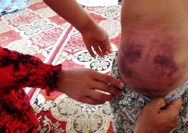 sanliurfada-3-evladina-canice-iskence-eden-cani-babanin-cezasi-belli-oldu-1639574486176.jpg Şanlıurfa’da 3 evladına canice işkence eden cani babanın cezası belli oldu - 2