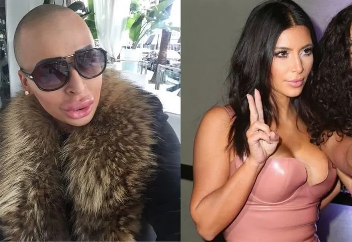 Kim Kardashian’a benzemek istedi!