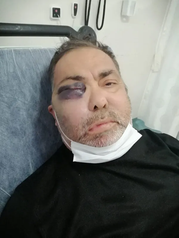 1614512818118.jpg Antalya'daki vahşetten acı haber! Mümin Kara hayatını kaybetti! - 2