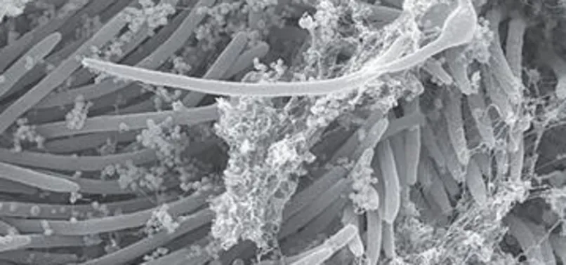 Dikkat çeken araştırma: Koronavirüs vücudu böyle işgal ediyor!
